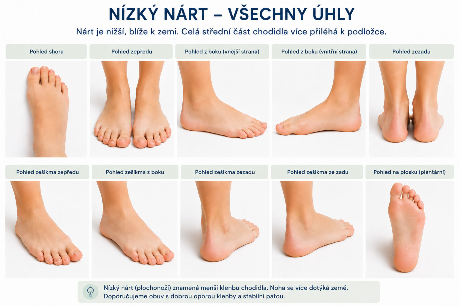 Nízký nárt u dětí – fotografie chodidla z různých úhlů
